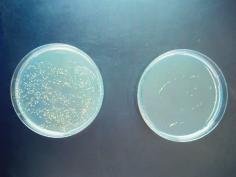 Antimikrobielle Oberflächen